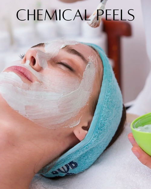 Chemical Peel